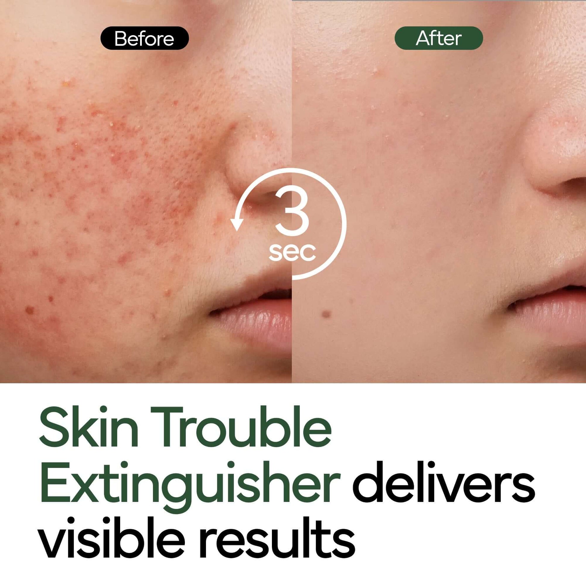 🖤New Arrival 50%OFF🖤 Intensive Cica Repair Cream-2