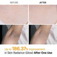 🖤2026 New Year · 40% OFF🖤Shot Keratin Care Kojic Acid Turmeric Spray-1