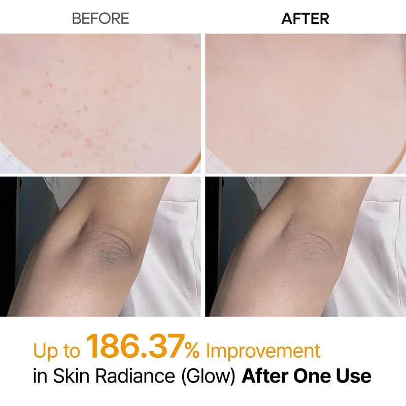 🖤2026 New Year · 40% OFF🖤Shot Keratin Care Kojic Acid Turmeric Spray-1