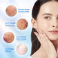 ✨Salicylic Acid Spot Drying Lotion - Targeted Blackhead Treatment for Clearer Skin-2