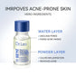 ✨Salicylic Acid Spot Drying Lotion - Targeted Blackhead Treatment for Clearer Skin-4