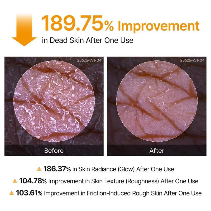 🖤2026 New Year · 40% OFF🖤Shot Keratin Care Kojic Acid Turmeric Spray-4