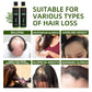 💖 See Real Results Faster -Tgideas® Organic Rosemary Hair Growth shampoo-1