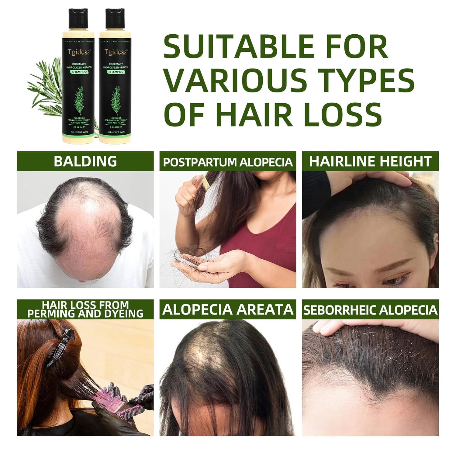 💖 See Real Results Faster -Tgideas® Organic Rosemary Hair Growth shampoo-1