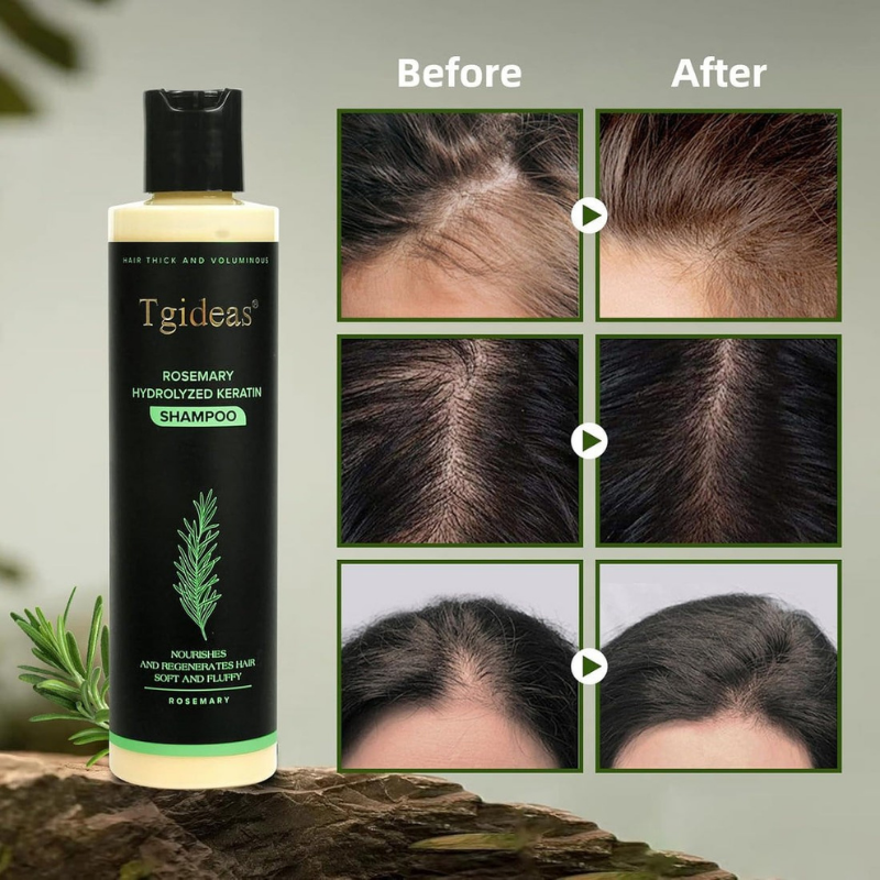 💖 See Real Results Faster -Tgideas® Organic Rosemary Hair Growth shampoo-4