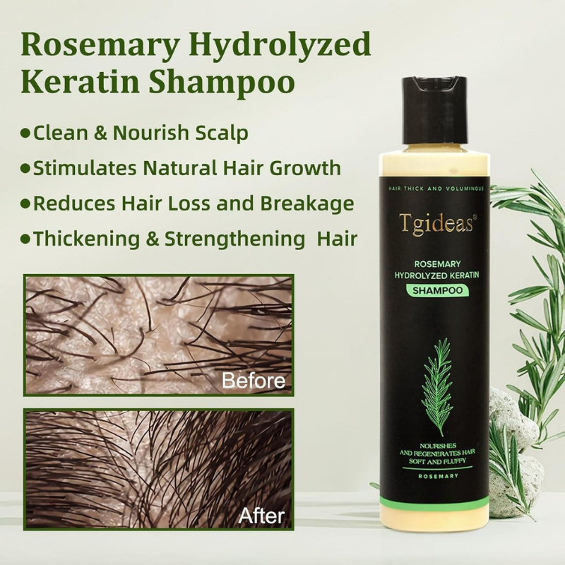 💖 See Real Results Faster -Tgideas® Organic Rosemary Hair Growth shampoo-2