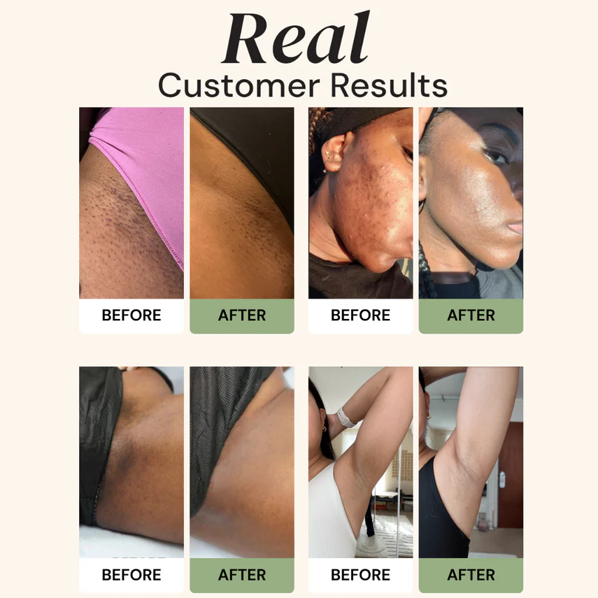 💜CuraGlow Anti-Spots & Hyperpigmentation Soap-2