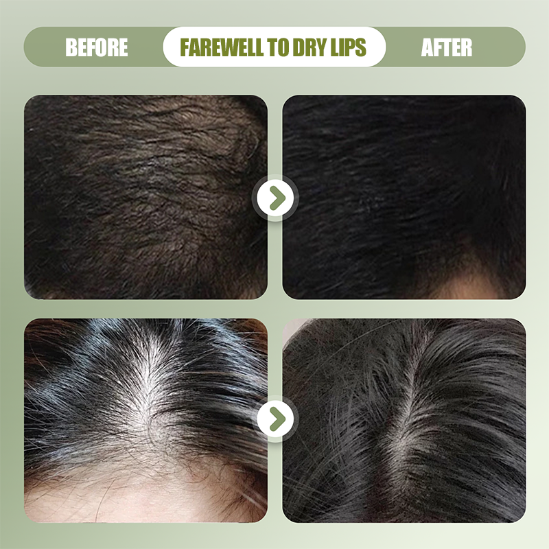 💖 See Real Results Faster🍃Natural Shampoo Bar For Strengthening Hair-2