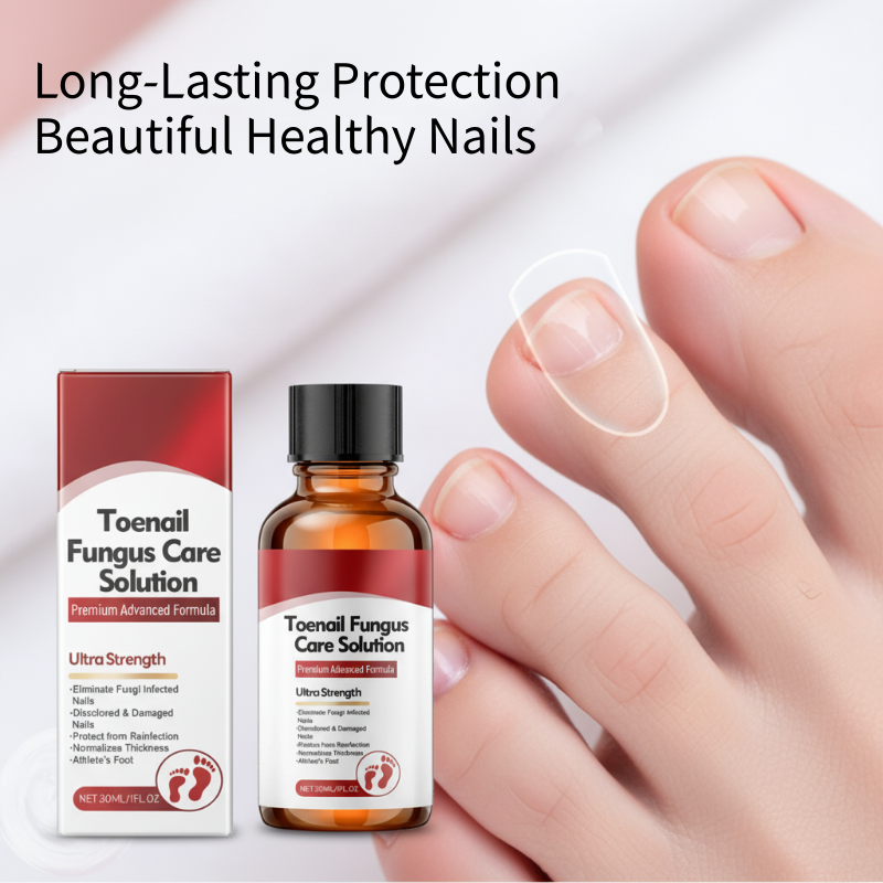 🖤See Real Results Faster🖤Nail Repair Essence for Damaged Nails💅🏻-6