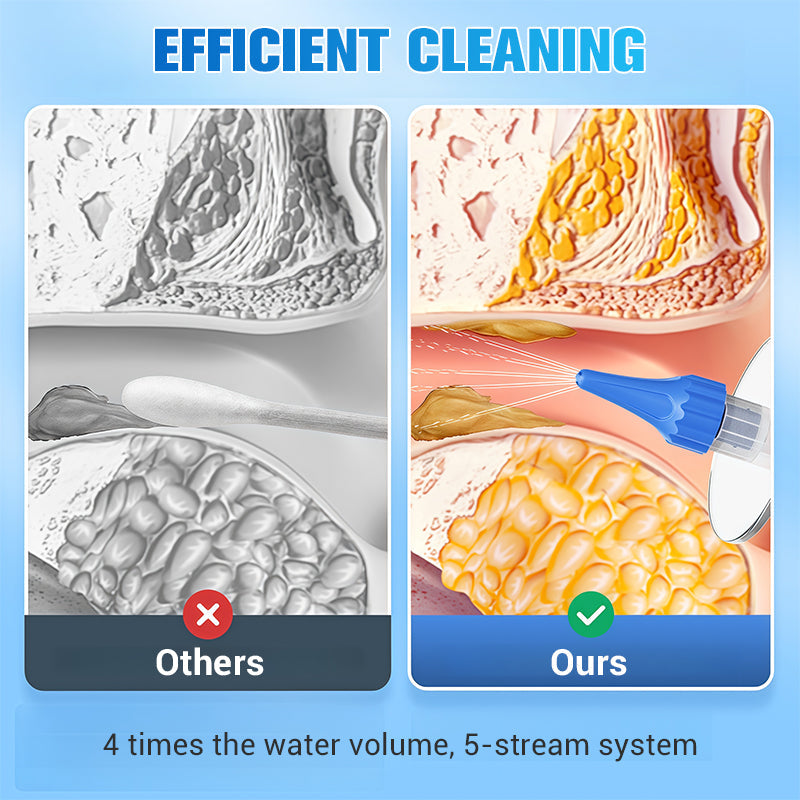 👂 HOT SALE! ⚡ Ear Wax Removal Kit – Safe & Gentle, Reusable Silicone Spoon, Easy to Use, Effective & Hygienic for Ear Cleaning ✨-4
