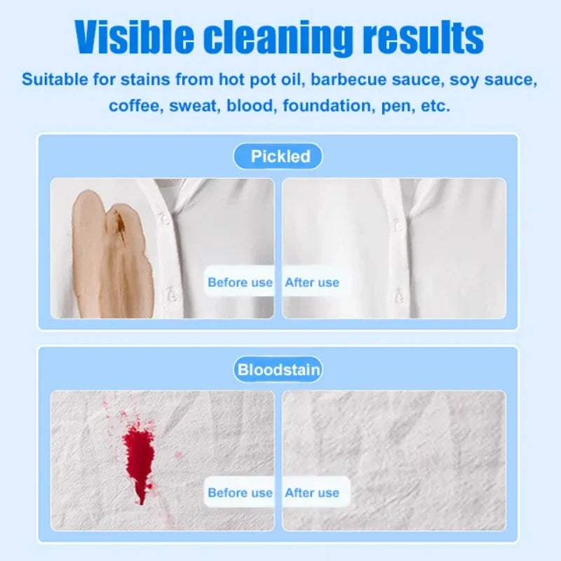 Stain Removal Wet Wipes For Clothes-3