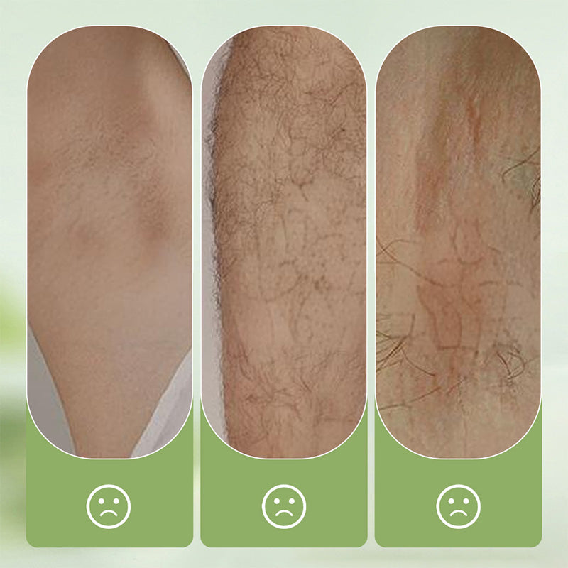 Gentle and Non-Irritating Hair Removal Cream-4