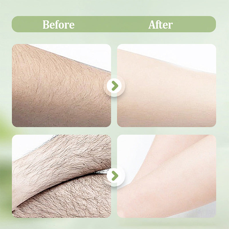Gentle and Non-Irritating Hair Removal Cream-5