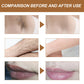 💜Gentle Hair Removal Cream for Smooth Skin-7