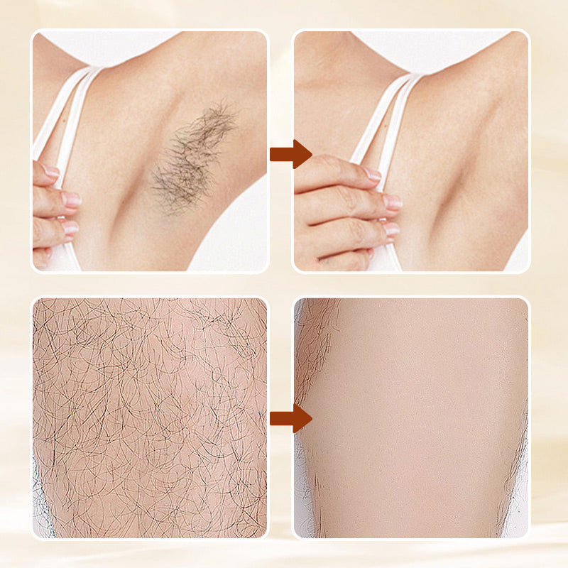 🖤See Real Results Faster🖤Versatile Aromatic Mild Formula Hair Removal Cream-1