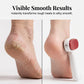 💎 Double-Sided Foot Scraper for Callus Removal